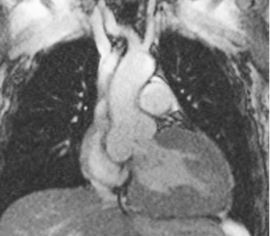 Cardiac Magnetic Resonance